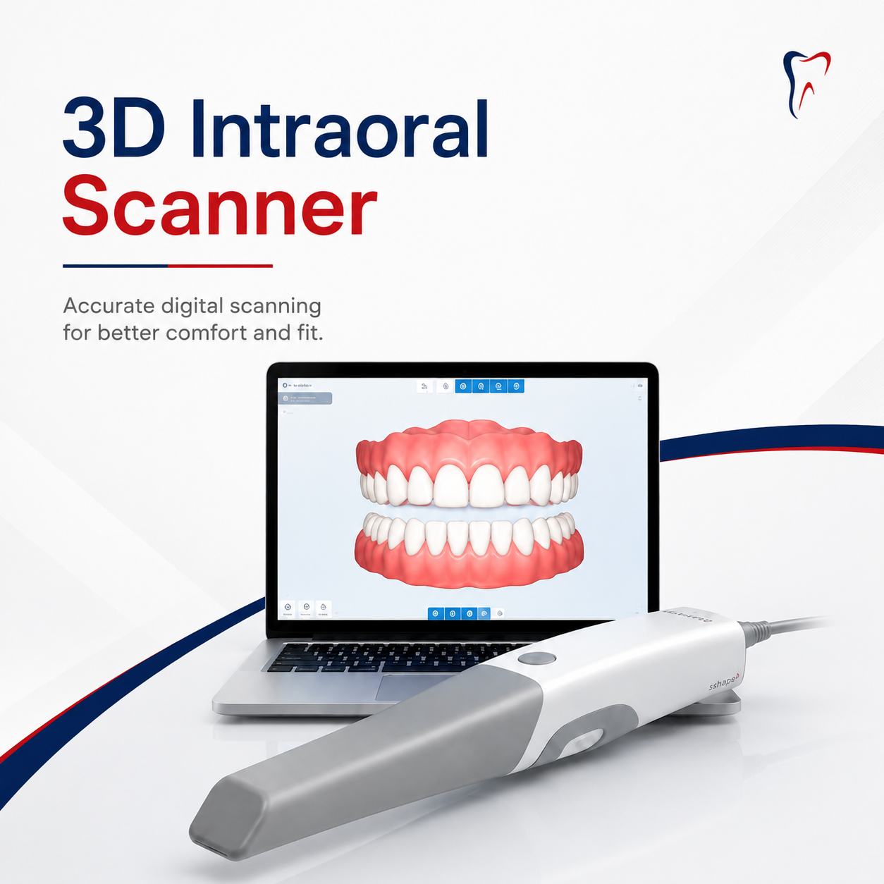 3D Intraoral Scanner at Niha's Dental Care Karur